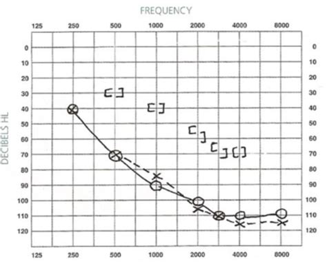 audiology quizlet pediatric and hard to test populations|AUDIOLOGY FINAL .